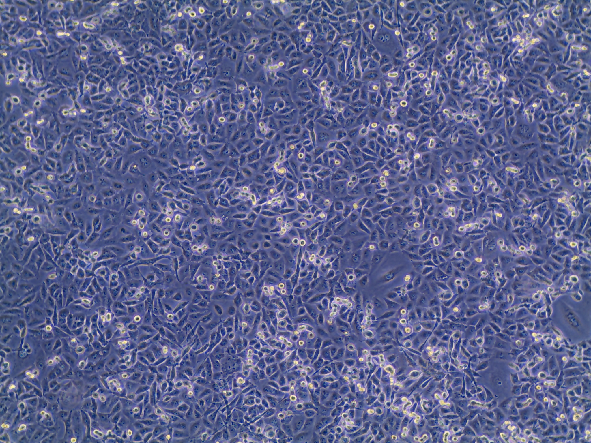 MDA-MB-231 myco-.jpg